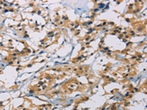 Rabbit Polyclonal Antibody to CSNK1E