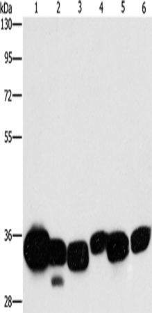 Rabbit Polyclonal Antibody to CBR1