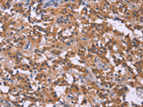 Rabbit Polyclonal Antibody to PIP5K1B