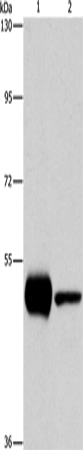 Rabbit Polyclonal Antibody to PIP4K2A