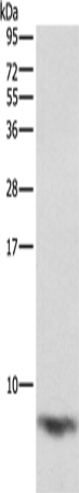 Rabbit Polyclonal Antibody to FXYD1
