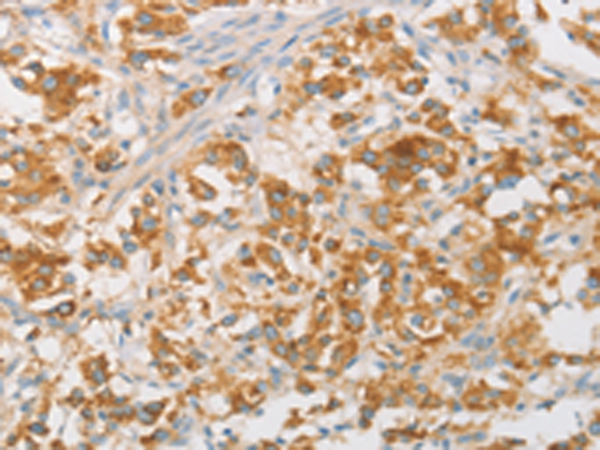 Rabbit Polyclonal Antibody to NPPB