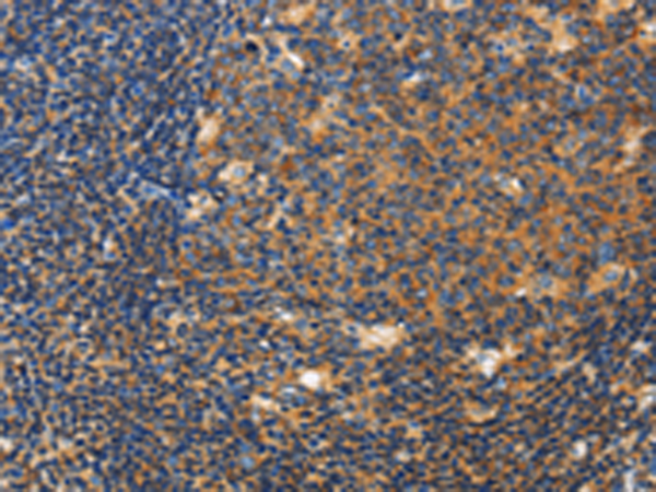 Rabbit Polyclonal Antibody to CERK