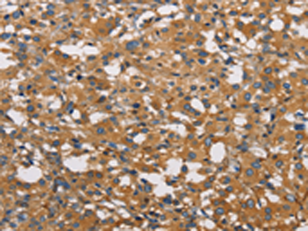 Rabbit Polyclonal Antibody to NPPA