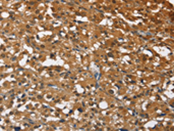 Rabbit Polyclonal Antibody to STK17B