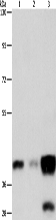 Rabbit Polyclonal Antibody to ASAH1