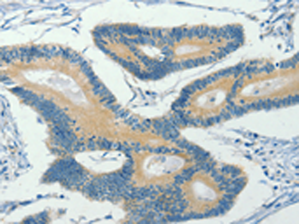 Rabbit Polyclonal Antibody to ASB8