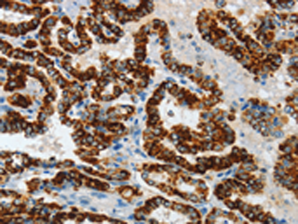 Rabbit Polyclonal Antibody to ASB4