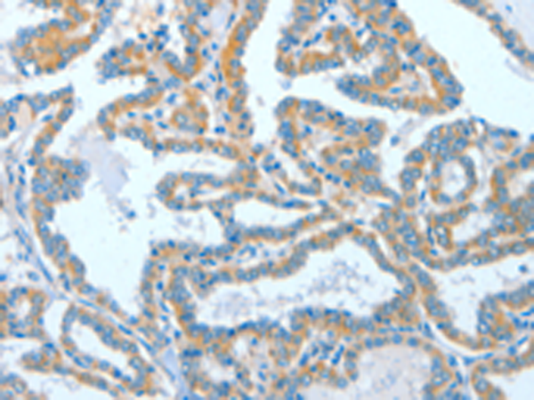 Rabbit Polyclonal Antibody to ASCC1