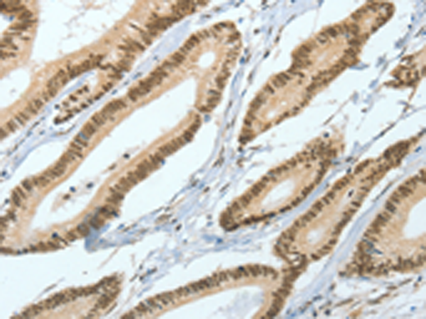 Rabbit Polyclonal Antibody to ASH2L