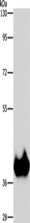 Rabbit Polyclonal Antibody to ASPA