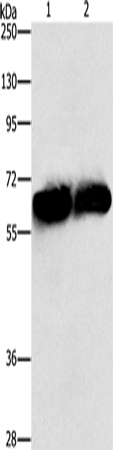 Rabbit Polyclonal Antibody to ASNS
