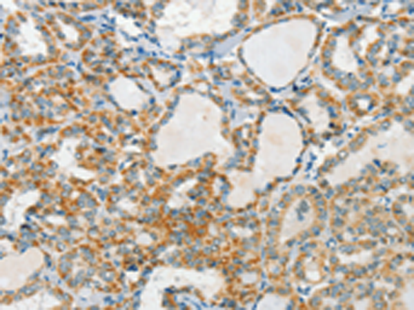 Rabbit Polyclonal Antibody to AANAT