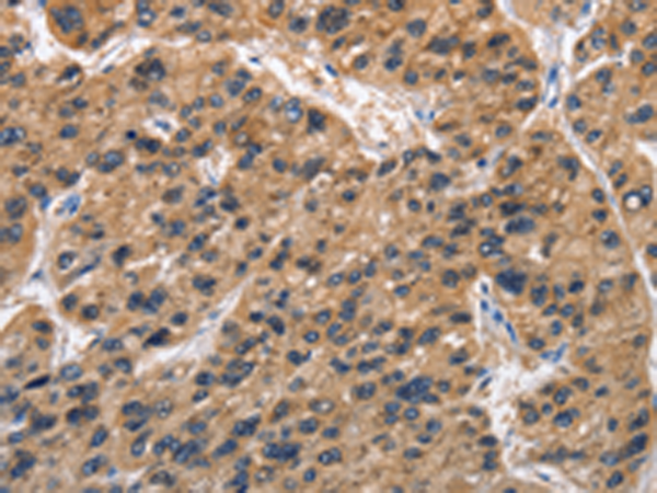 Rabbit Polyclonal Antibody to ABI3BP