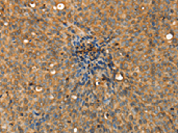 Rabbit Polyclonal Antibody to ADCY3