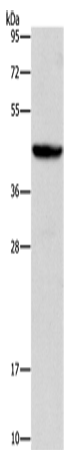 Rabbit Polyclonal Antibody to ORM2