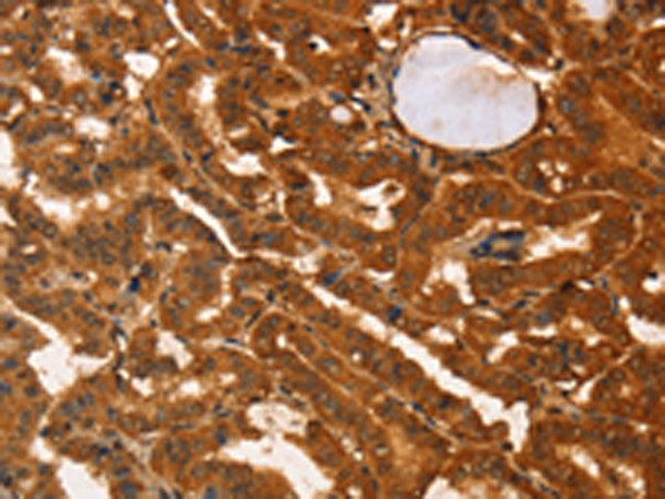Rabbit Polyclonal Antibody to IKZF3