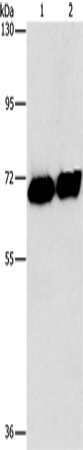 Rabbit Polyclonal Antibody to ALPP