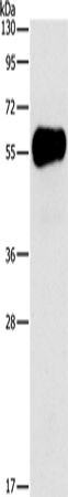 Rabbit Polyclonal Antibody to AMY2A