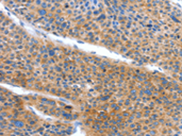 Rabbit Polyclonal Antibody to ARL11