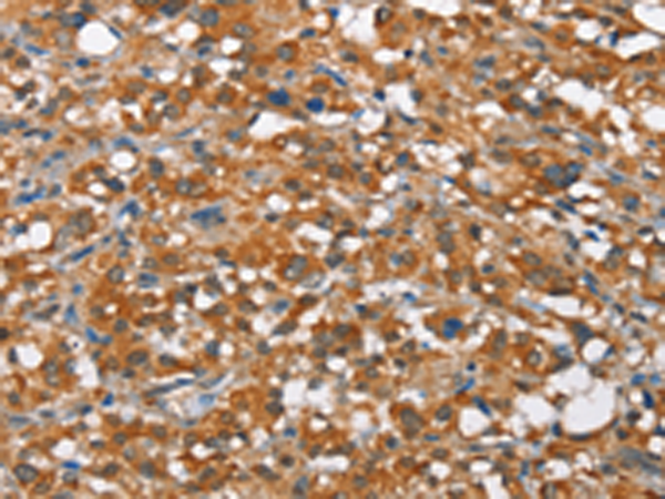 Rabbit Polyclonal Antibody to ARMCX2