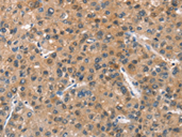 Rabbit Polyclonal Antibody to ASB2