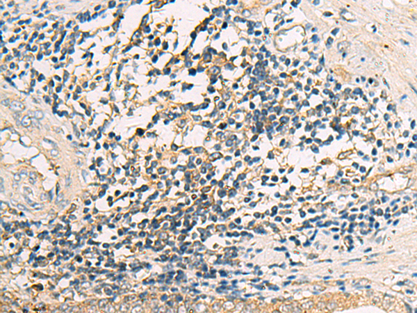 Rabbit Polyclonal Antibody to ASB10