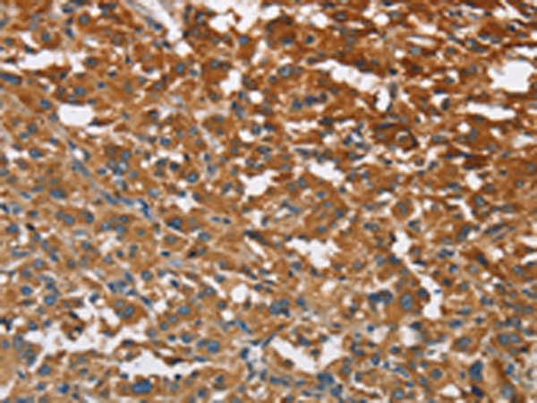 Rabbit Polyclonal Antibody to ATP1B2