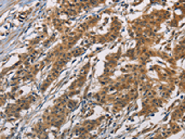 Rabbit Polyclonal Antibody to ATP2C1