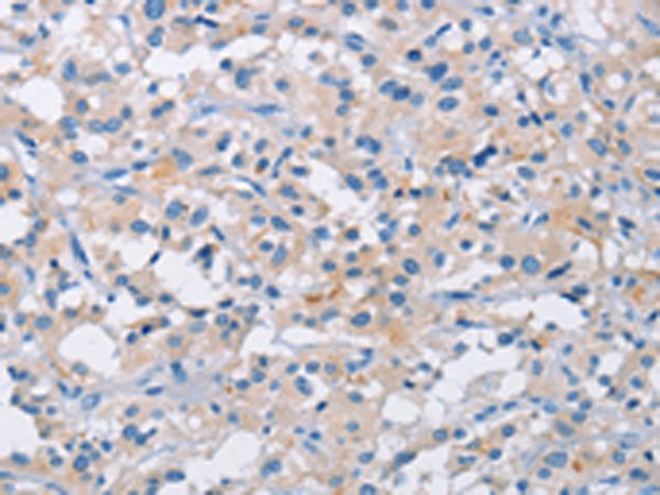 Rabbit Polyclonal Antibody to ATP6AP2