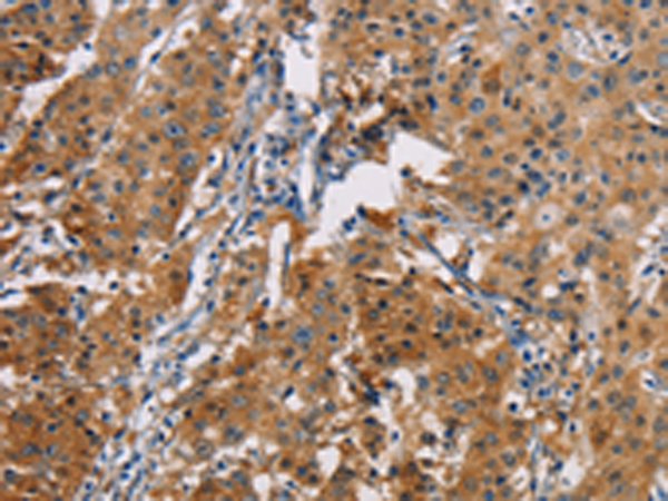 Rabbit Polyclonal Antibody to PDCD1LG2