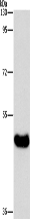 Rabbit Polyclonal Antibody to BAAT