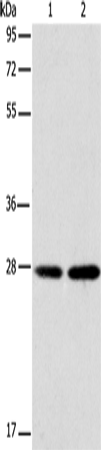 Rabbit Polyclonal Antibody to BCAS2