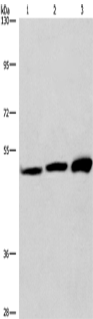 Rabbit Polyclonal Antibody to VWA5A