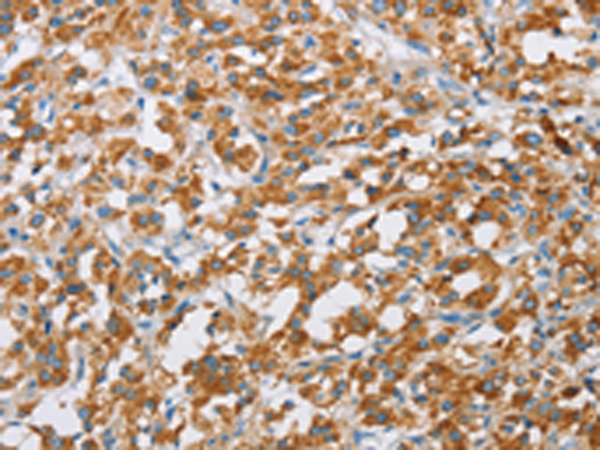 Rabbit Polyclonal Antibody to BDH1