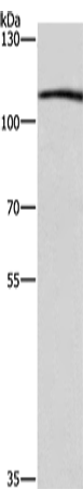Rabbit Polyclonal Antibody to COPB1