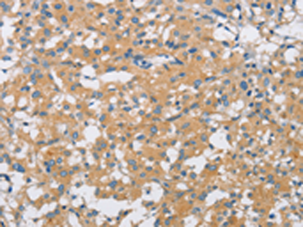 Rabbit Polyclonal Antibody to SH3GLB1