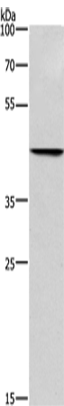 Rabbit Polyclonal Antibody to BGN