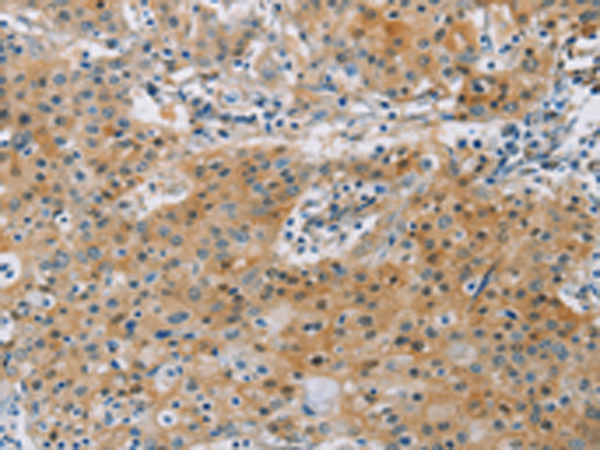 Rabbit Polyclonal Antibody to KCNMA1