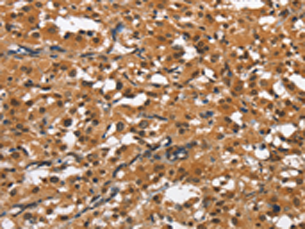 Rabbit Polyclonal Antibody to SLAMF8