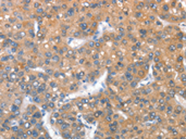 Rabbit Polyclonal Antibody to KEL