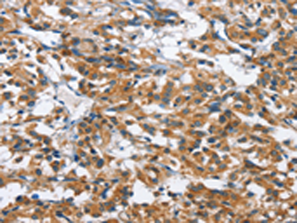 Rabbit Polyclonal Antibody to BPI