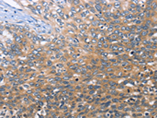 Rabbit Polyclonal Antibody to BABAM2