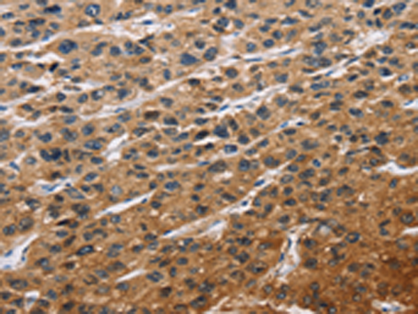 Rabbit Polyclonal Antibody to EIF4EBP2