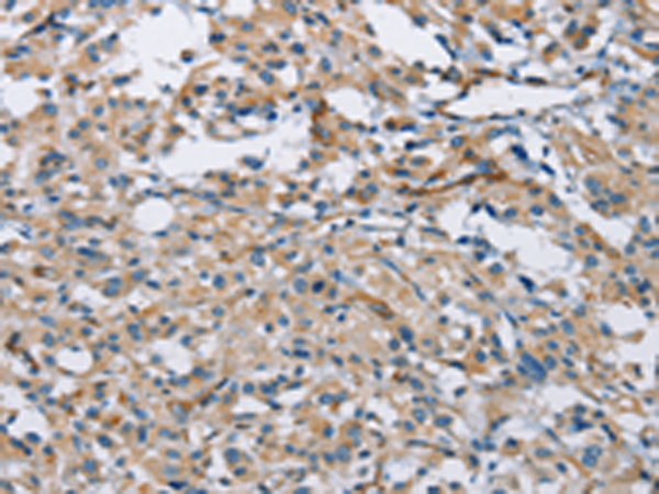Rabbit Polyclonal Antibody to PTK6