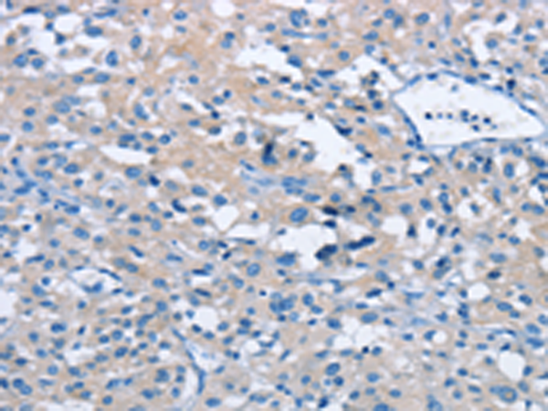 Rabbit Polyclonal Antibody to BTN2A2