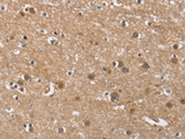 Rabbit Polyclonal Antibody to BUB1