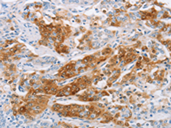 Rabbit Polyclonal Antibody to C3AR1