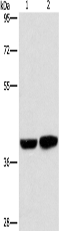 Rabbit Polyclonal Antibody to CAB39L