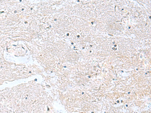 Rabbit Polyclonal Antibody to CACNB1